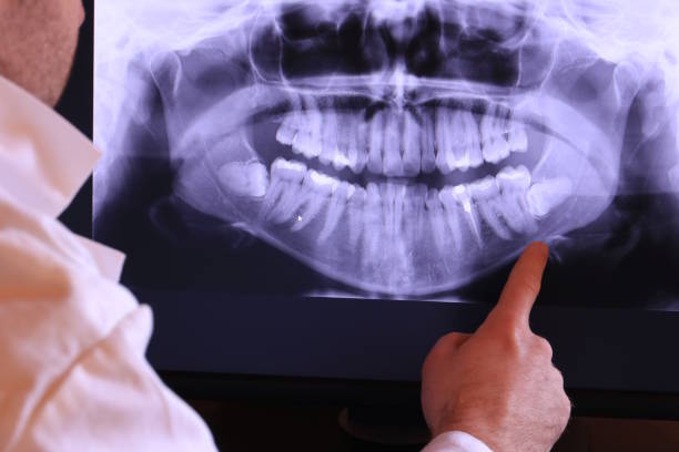 Best Emergency Dental Surgery in Ames, TX