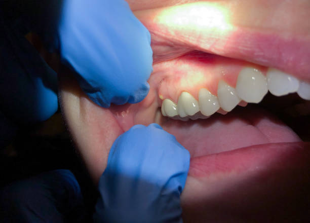 Best After-Hours Emergency Dentist in Ames, TX